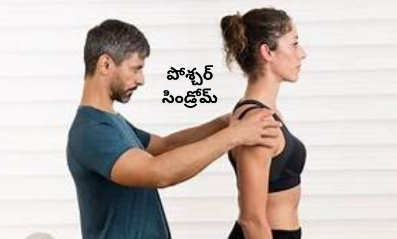 Posture syndrome