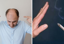 Cigarette smokers (1)