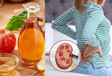 Apple cider vinegar