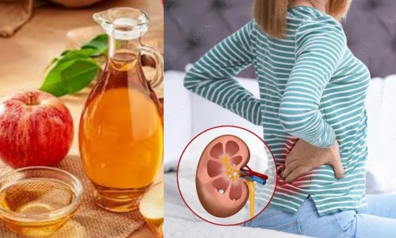 Apple cider vinegar