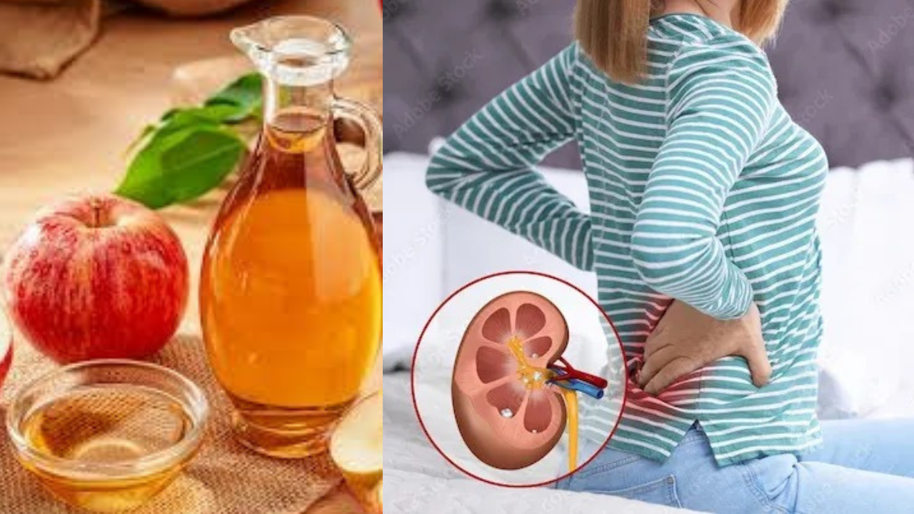 Apple cider vinegar