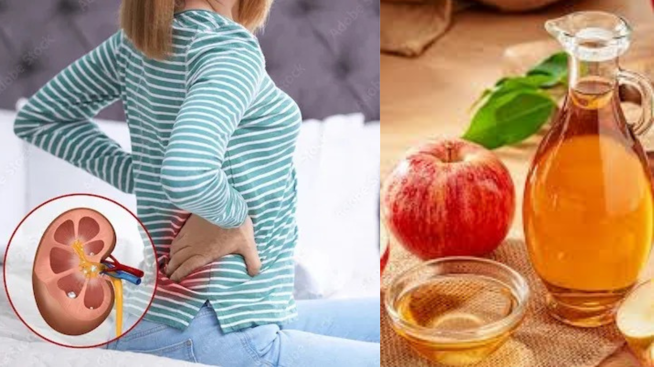 Apple cider vinegar