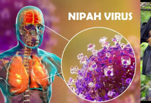 Nipah Virus