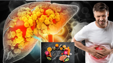 Fatty Liver