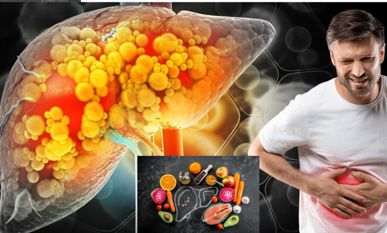 Fatty Liver