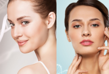 Collagen