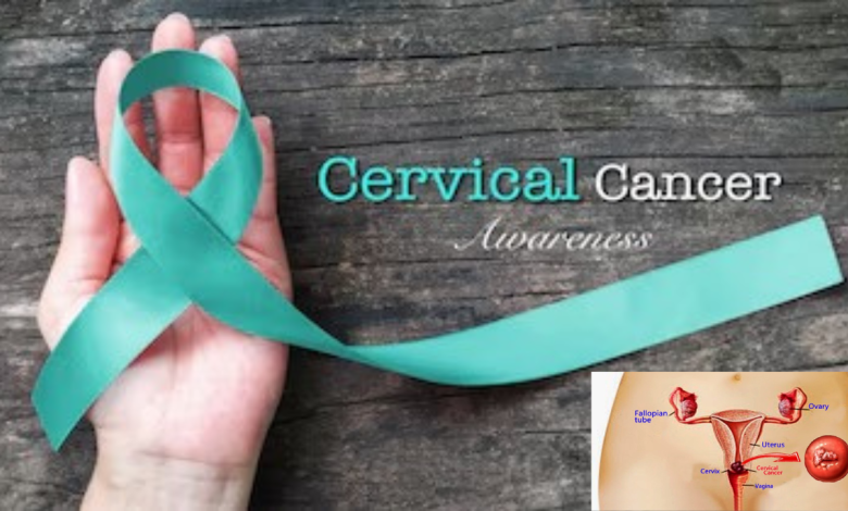 Cervical Cancer