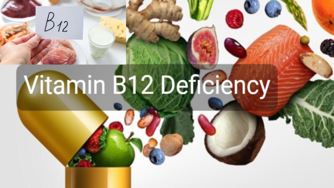 Vitamin B12