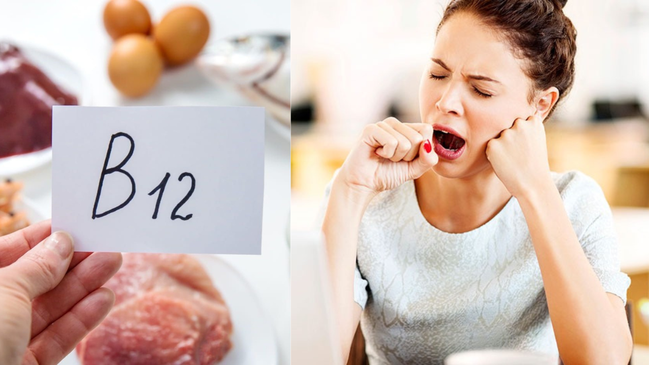 Vitamin B12