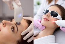 Laser Hair Removal
