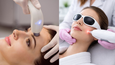 Laser Hair Removal