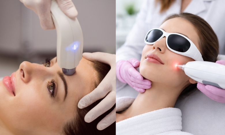 Laser Hair Removal