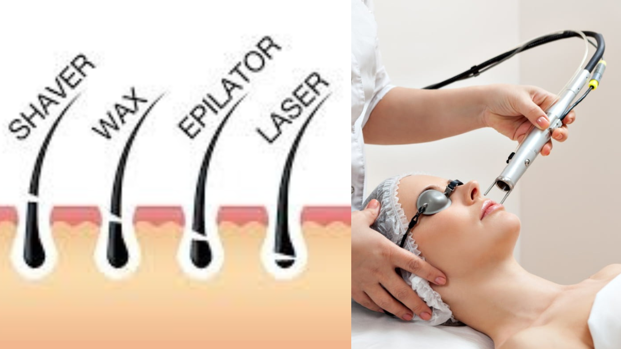 Laser Hair Removal 