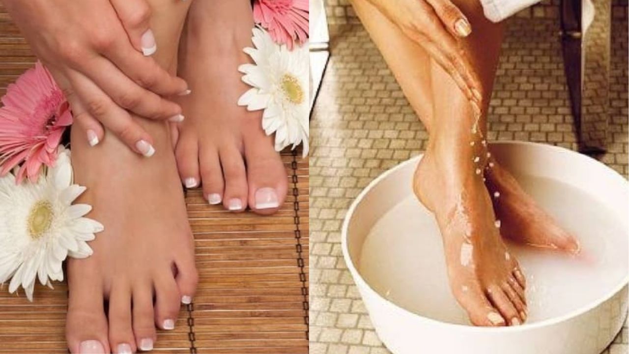 Cracked Heels