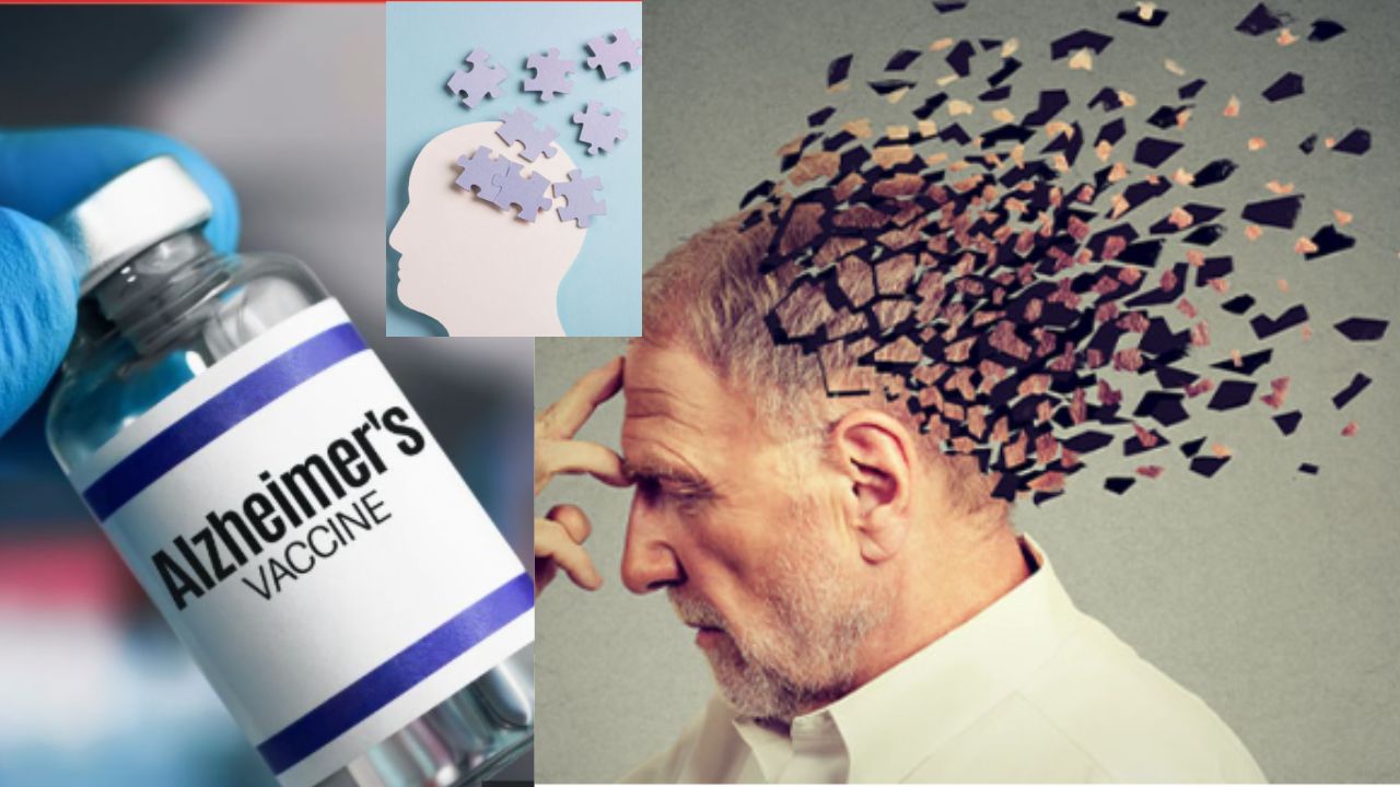 Alzheimer