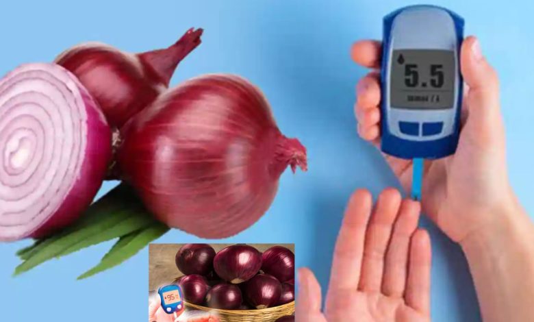 Onion