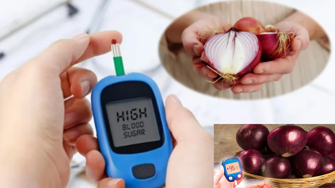 Onion