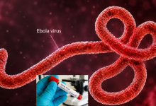 Ebola Virus