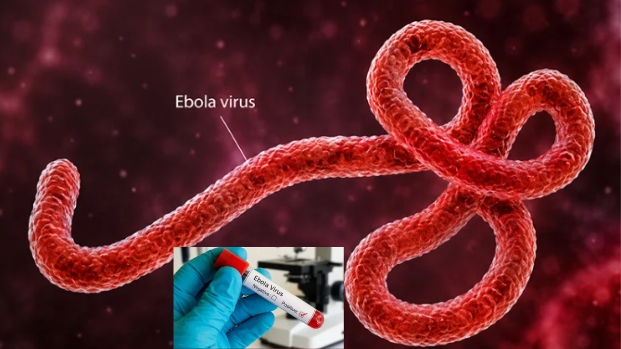 Ebola Virus