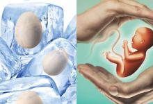 Egg Freezing