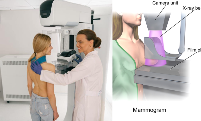 Mammogram