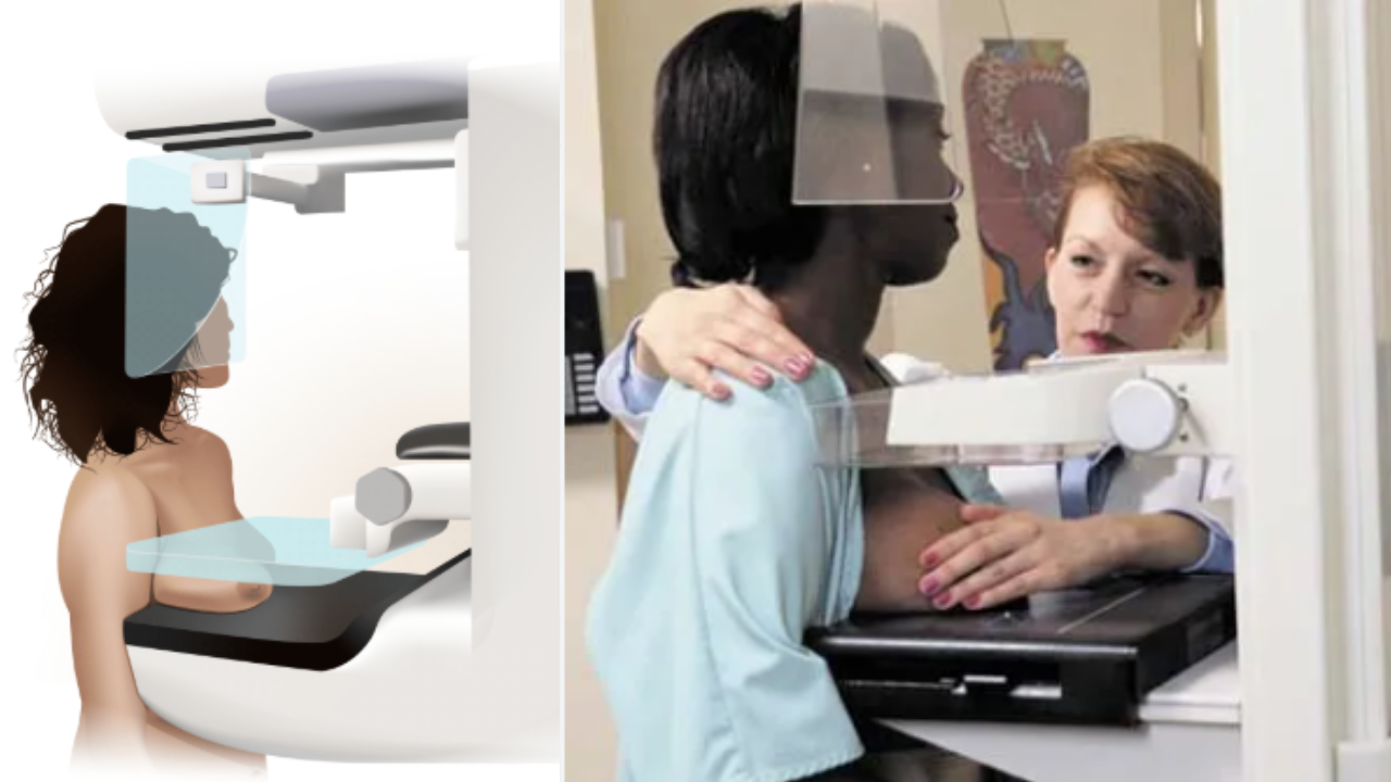 Mammogram