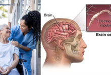 Brain Problems