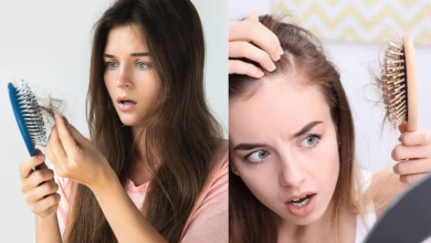 Hair Loss