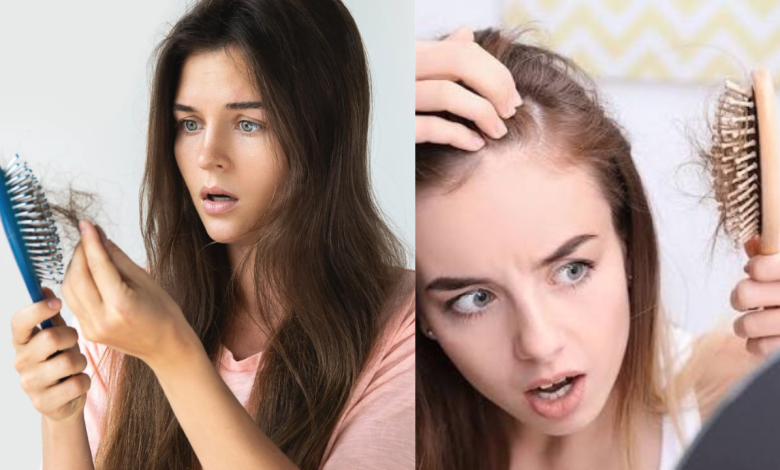 Hair Loss