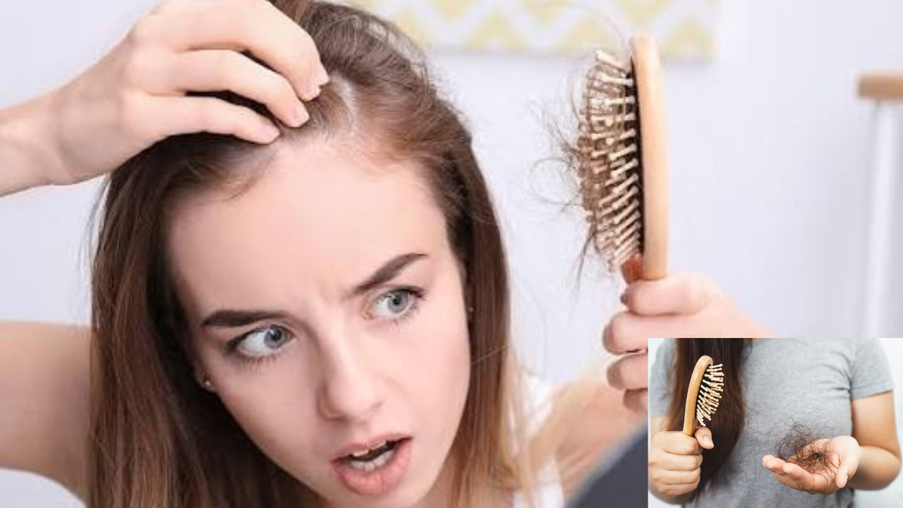 Hair Loss