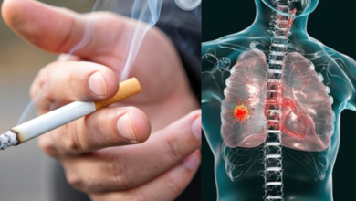 Quit Smoking