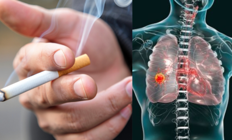 Quit Smoking