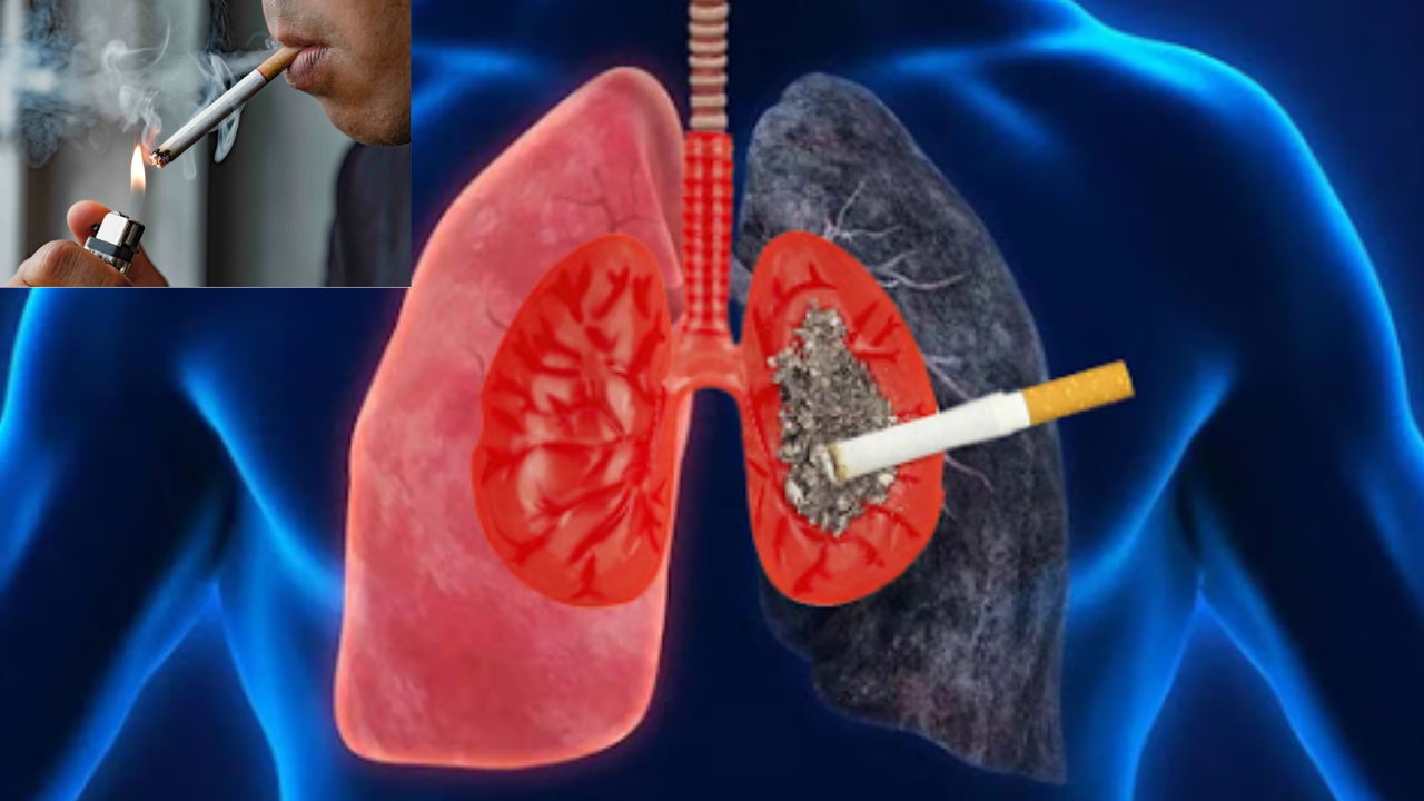 Quit Smoking